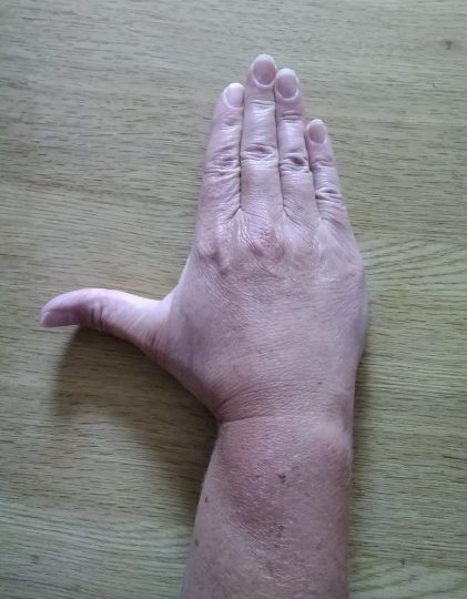 Person with their palm facing down on a table with their thumb spread away from their index finger.